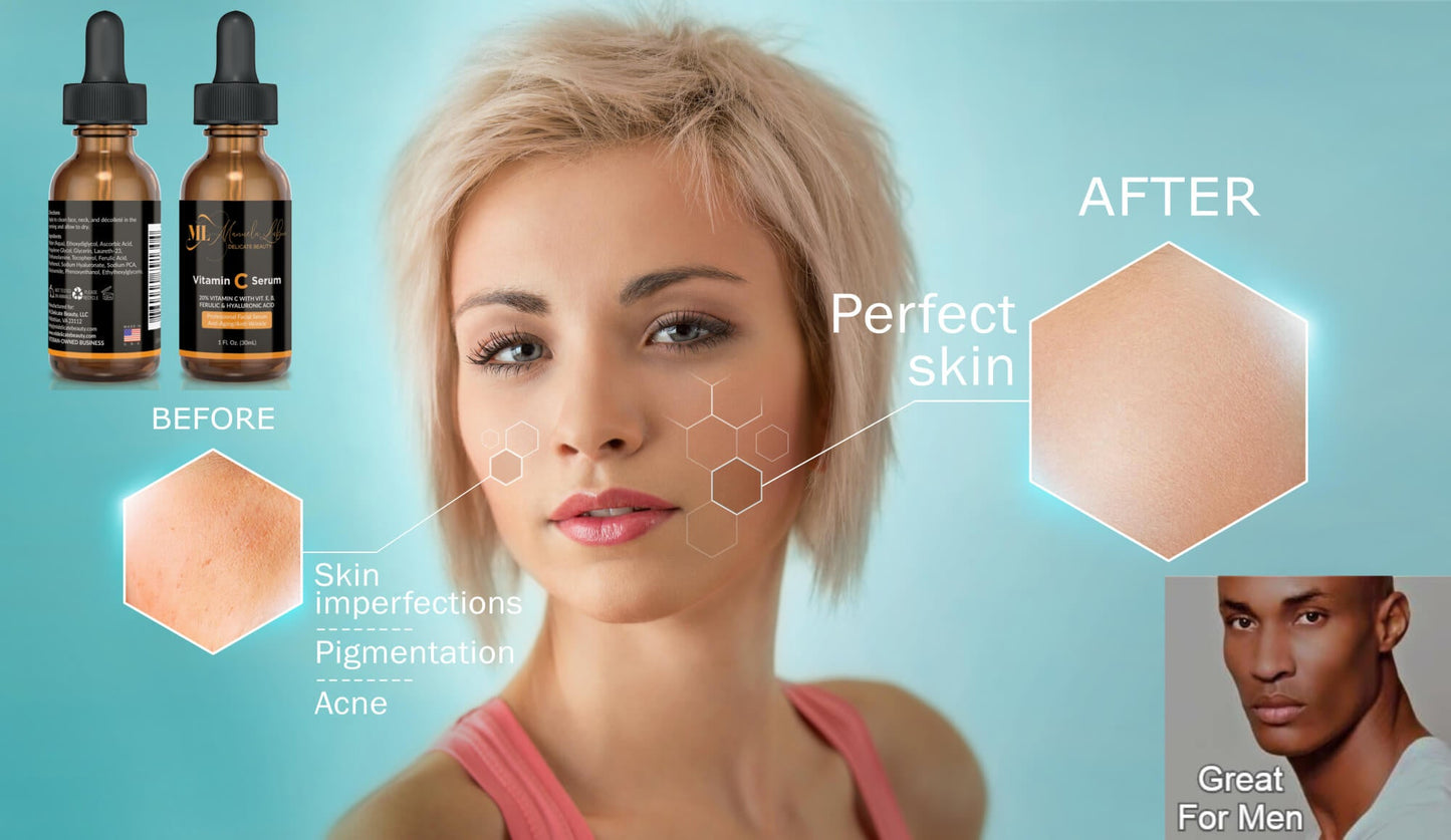 Acne Resolve + Radiant Skin Advanced Anti-Aging Vitamin C Serum,